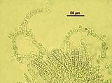 Corynophlaea flaccida5